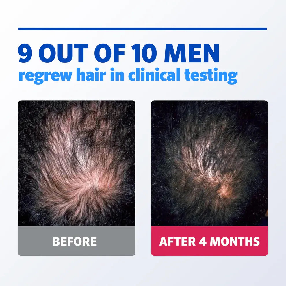 Men's ROGAINE® 5% Minoxidil Unscented Foam - 3-Month Supply